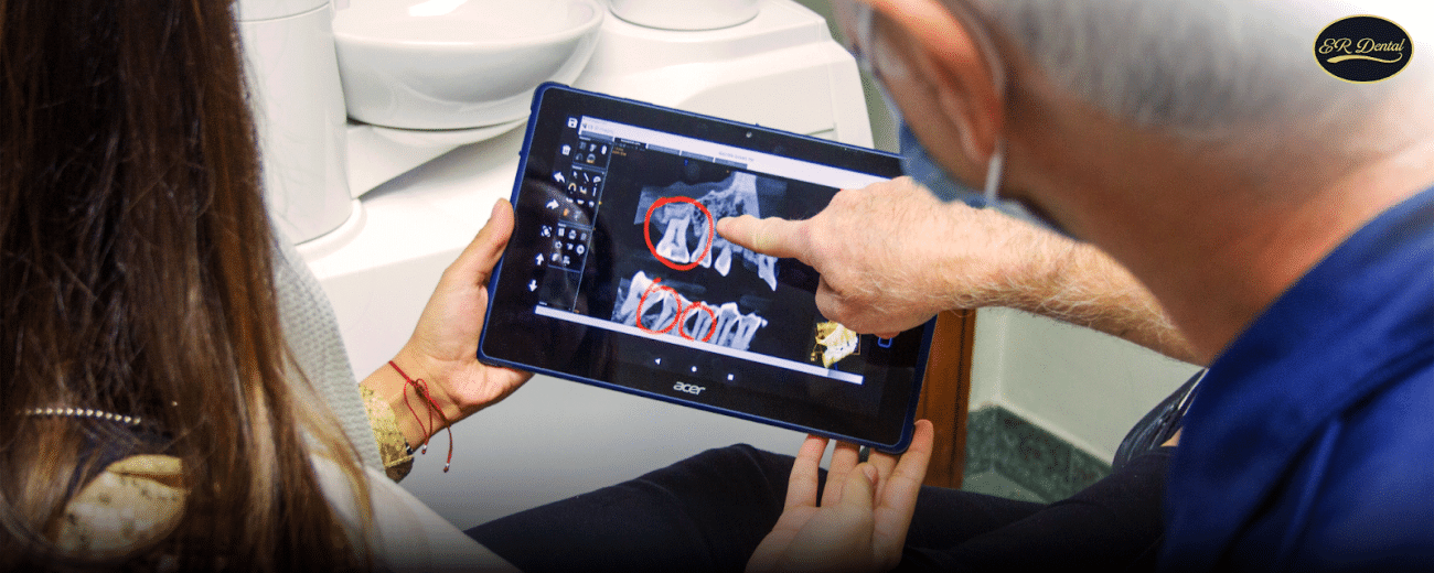 Dentist showing wisdom teeth x-ray on tablet to patient